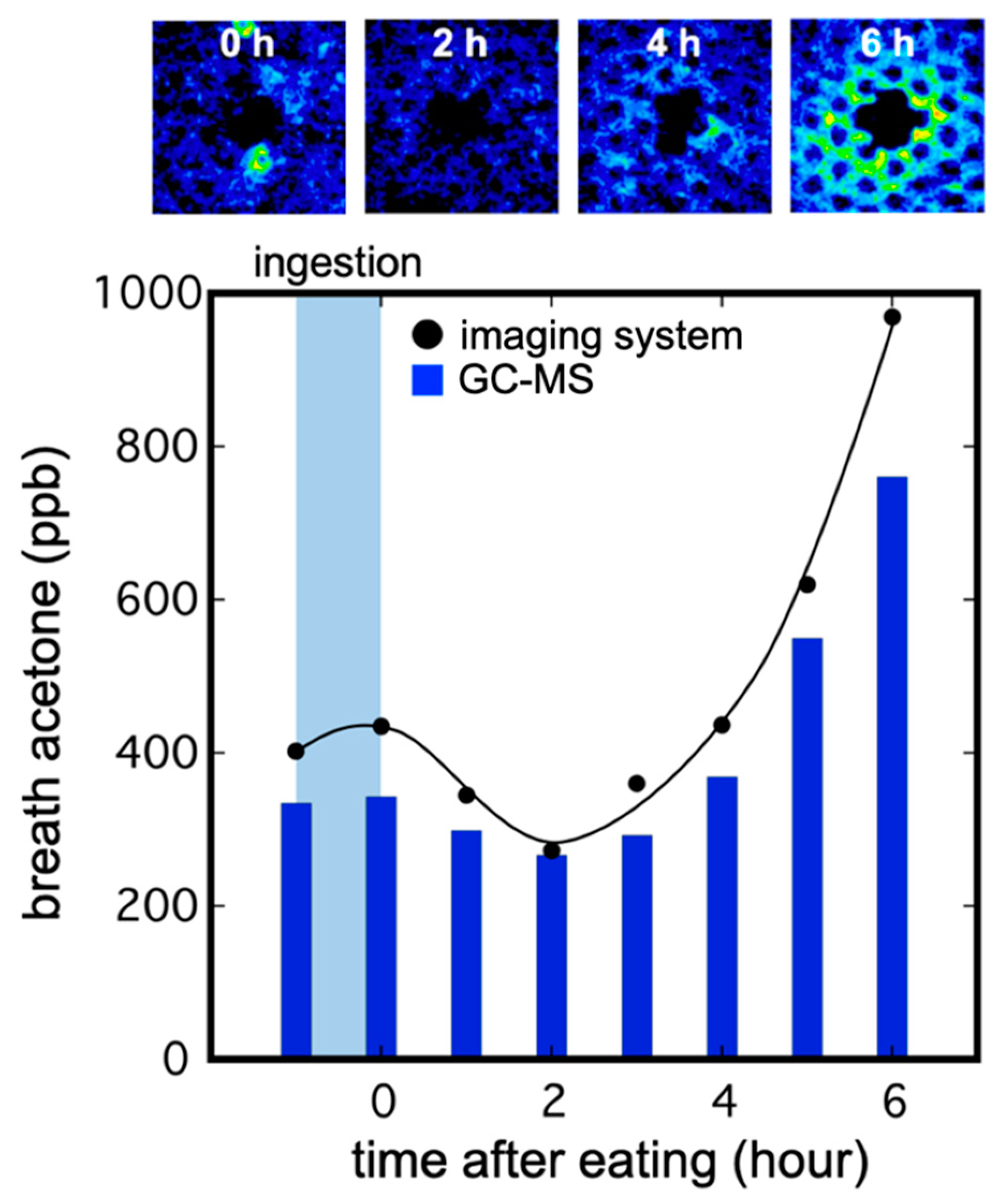 A Bio-Fluorometric Acetone Gas Imaging System for the Dynamic Analysis of Lipid Metabolism in Human Breath